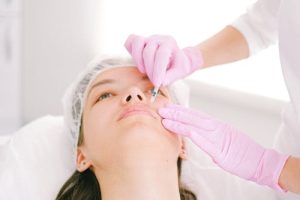 Natuurlijk vollere lippen: ontdek de mogelijkheden van lip fillers in Den Haag