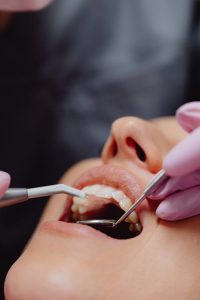 Waarom preventieve mondzorg essentieel is